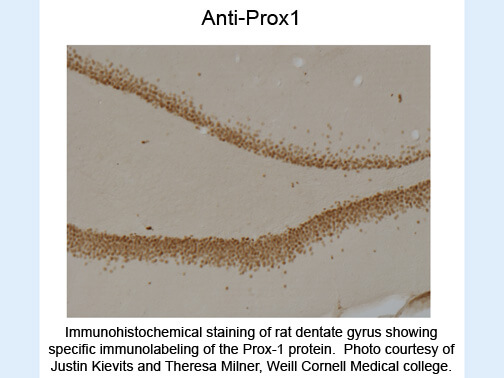 Immunohistochemical staining of Anti-Prox1 (Mouse) Antibody - 200-301-E18