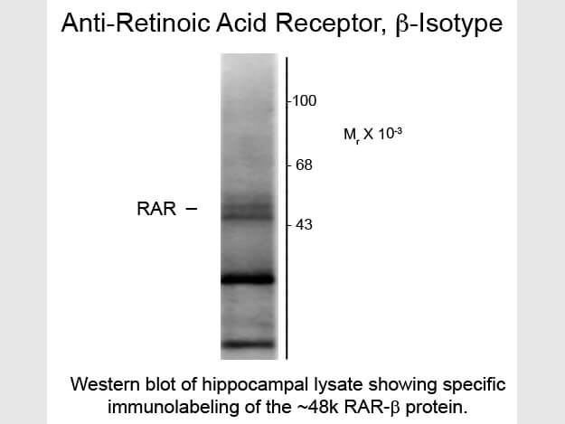 Western blot of Anti-Retinoic Acid Receptor beta (Mouse) Antibody - 209-301-E26