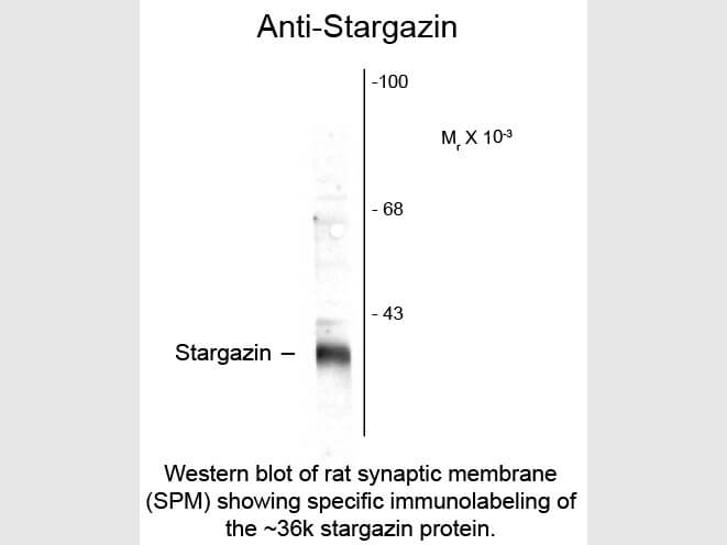 Western blot of Anti-Stargazin (Rabbit) Antibody - 600-401-E32