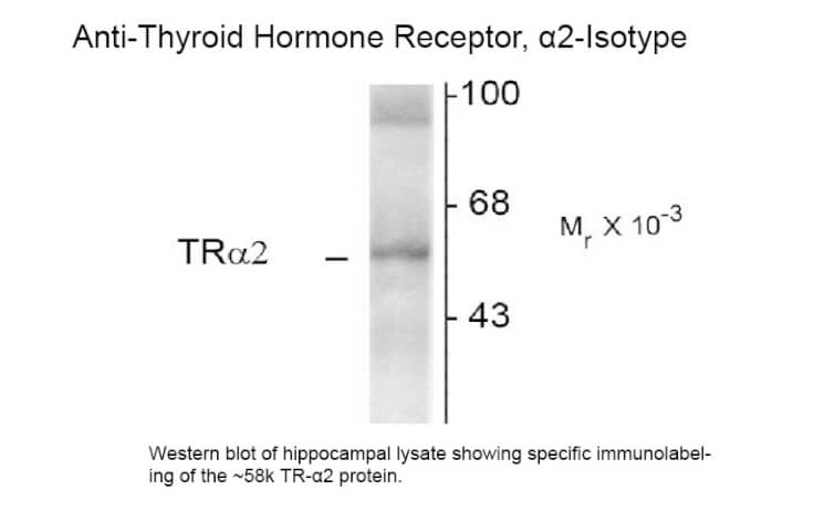 Thyroid Hormone Receptor alpha 2 Antibody