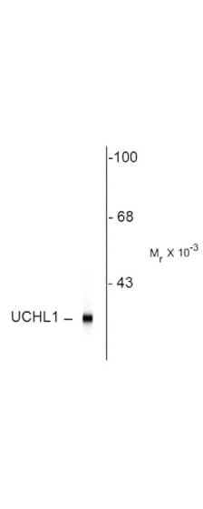 Western Blot - Ubiquitin Hydrolase (UCHL1)
