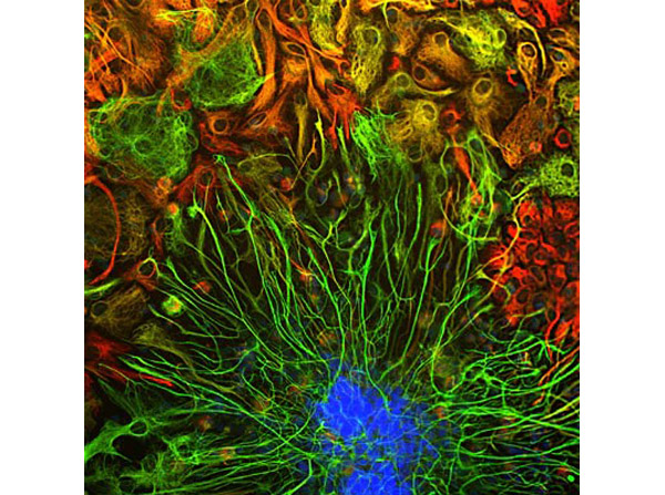 Immunostaining of anti-vimentin