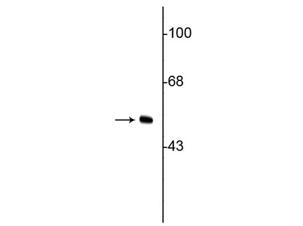 Western blot of anti-Vimentin