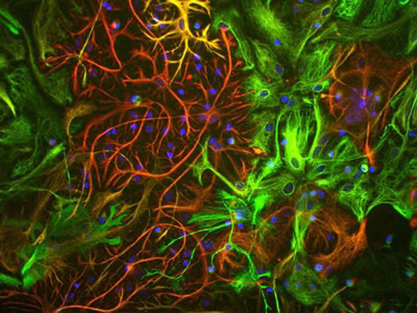 Immunostaining of anti-vimentin