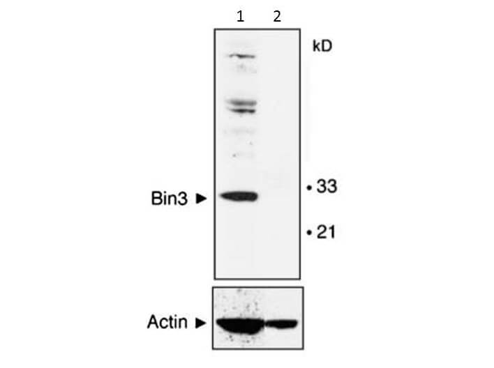 Western Blot - BIN3 Antibody