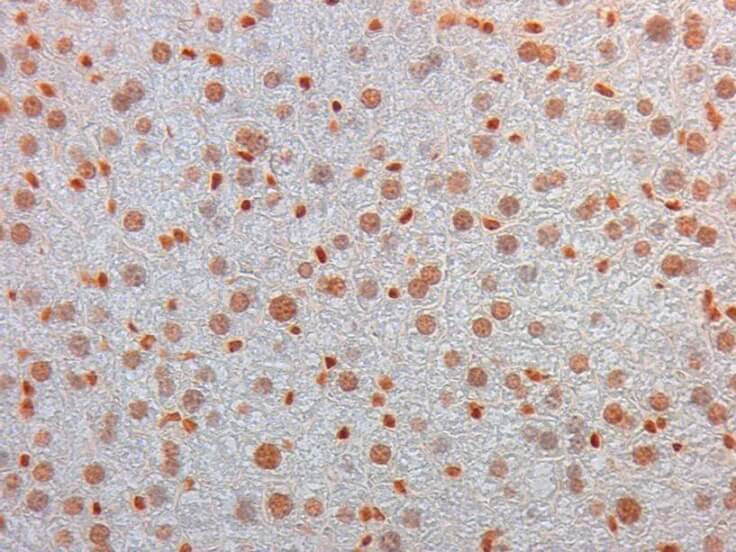 Immunohistochemistry of Mouse Monoclonal anti AKT3 Antibody in Mouse Embryonic Kidney. Tissue: Mouse Liver. Fixation: FFPE buffered formalin 10% conc. Ag Retrieval: Heat, Citrate pH 6.2. Pressure Cooker. Primary antibody: anti-AKT3 at 2ug/ml for 1.5 hour @ room Temp. Secondary Ab: MOUSE ON MOUSE HRP POLYMER 45” RT.
