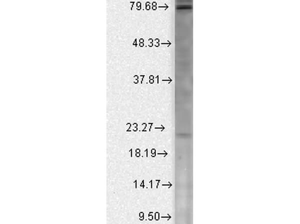 CAV BETA 2 Western Blot