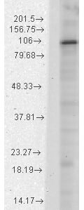 HCN1 Western Blot