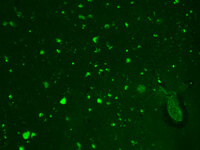 HCN2 Immunofluorescence