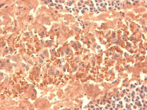 HCN4 Immunohistochemistry