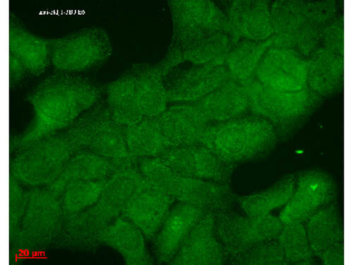 Hsp40 (Hdj1) Immunofluorescence