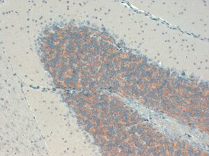 KCHIP Immunohistochemistry