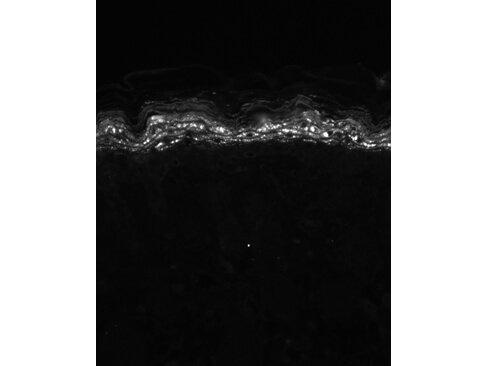 Kv1.5K+ Channel Immunohistochemistry