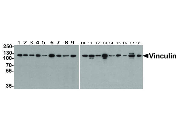 Western Blot of Vinculin Antibody