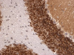 Kv4.2K+ Channel Immunohistochemistry