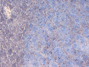 Nav1.2 Immunohistochemistry