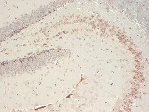 Nav1.6 Immunohistochemistry