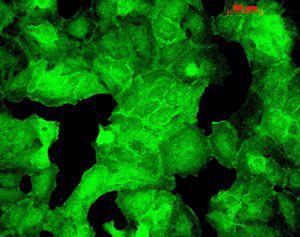 PSD95 Immunofluorescence