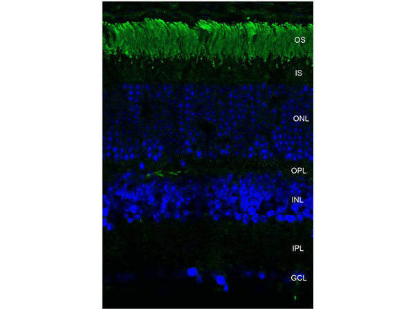 Immunohistochemistry of Mouse Anti-Rhodopsin