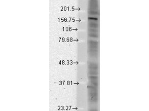 SHANK Western Blot