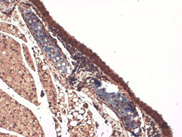 Immunohistochemistry of Mouse Anti-Sodium Iodide Symporter
