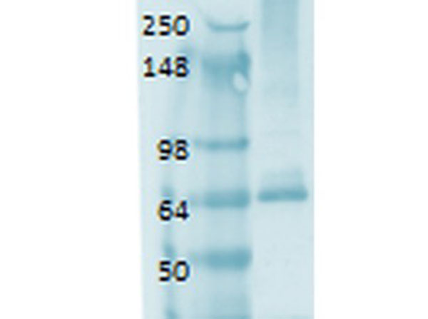 Western Blot of Anti-Sodium Iodide Symporter