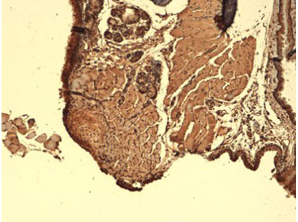 Immunohistochemistry of Mouse Anti-Sodium Iodide Symporter
