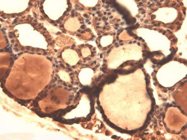 Immunohistochemistry of Mouse Anti-Sodium Iodide Symporter