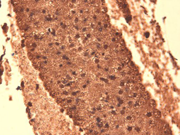 Immunohistochemistry of Mouse Anti-Sodium Iodide Symporter