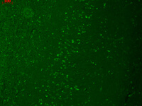 TRPM7 Immunofluorescence