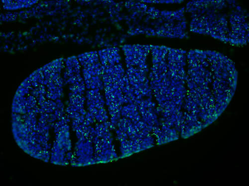 Immunofluorescence Microscopy - Mouse Anti-BrdU