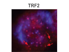TRF2 Immunofluorescence