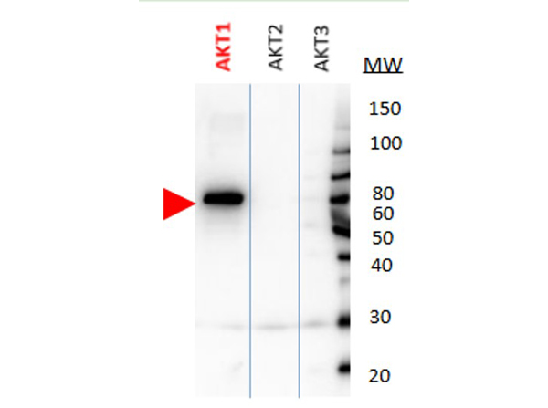 Western Blot of AKT isoforms