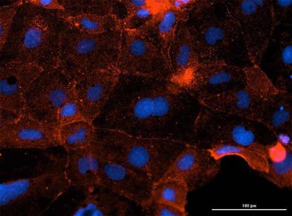 Immunofluorescence of hFcRn (ADM31) Antibody