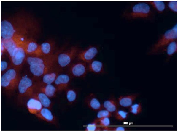 Immunofluorescence of hFcRn (ADM31) Antibody