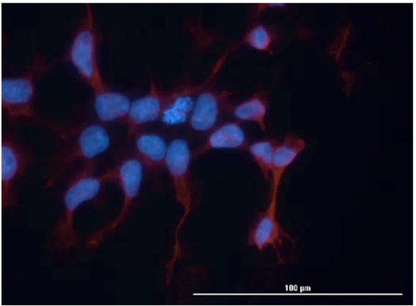 Immunofluorescence of hFcRn (DVN24) Antibody