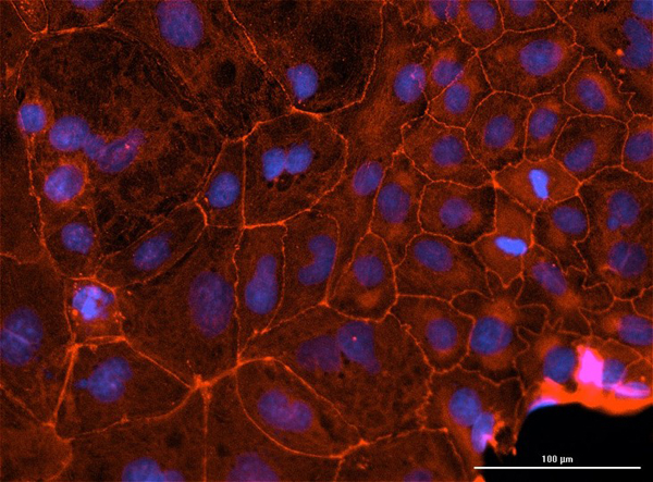 Immunofluorescence of Mouse Anti-hFcRn (DNV24) Antibody
