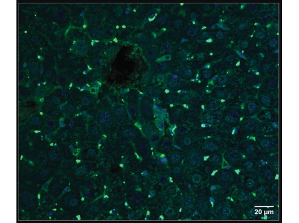 Biodistribution of ASO