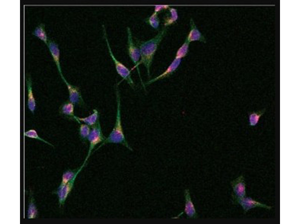 Colocalization of Cy5-conjugated PS-MOE ASO