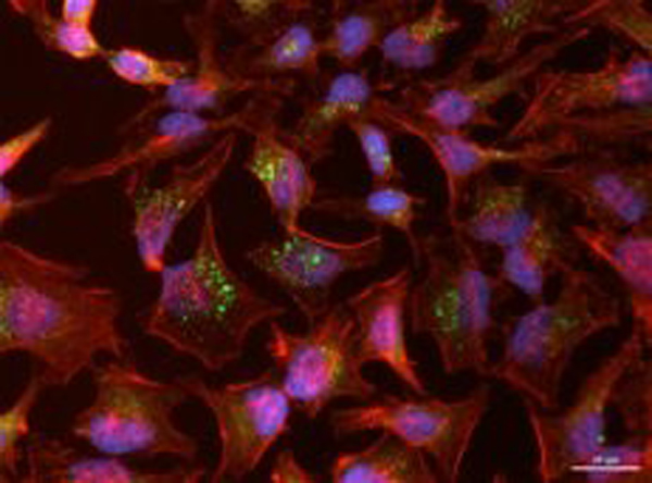 Immunofluorescence using OME01