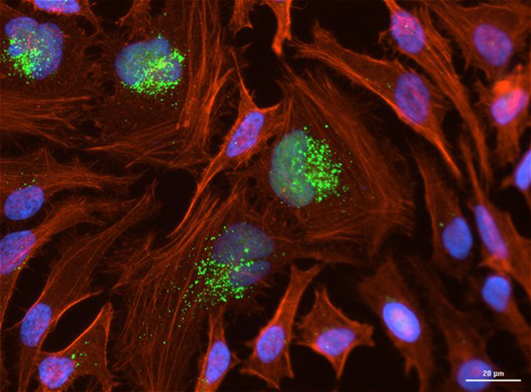 Immunofluorescence using OME03
