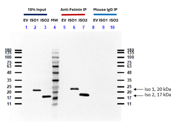 Immunoprecipitation using Anti-Feimin