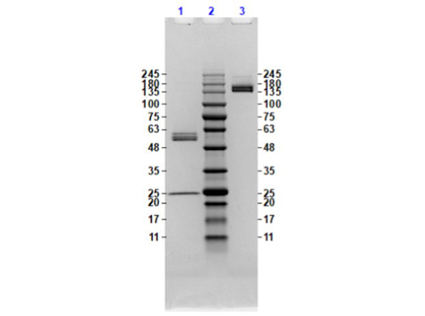 SDS Page using Anti-Feimin