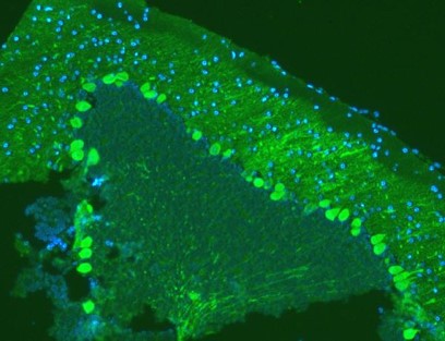 Immunofluorescence analysis of Calbindin-D