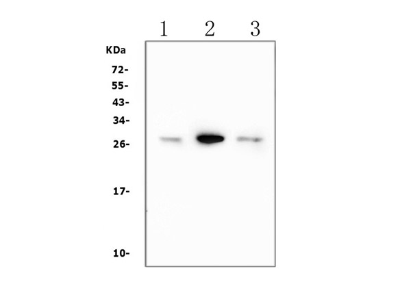 Western blot analysis of Calbindin-D