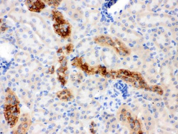 Immunohistochemistry of Mouse Anti-Calbindin-D antibody.