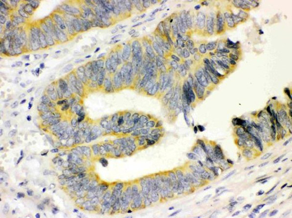 Immunohistochemistry of Mouse Anti-Calbindin-D antibody.