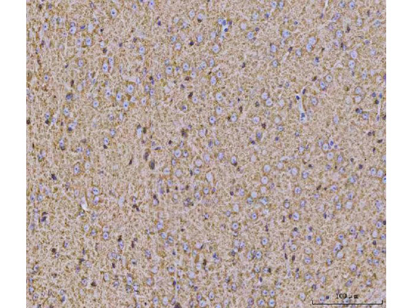 Immunohistochemistry analysis of Calcineurin Alpha