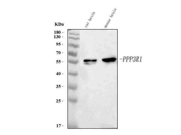 Western Blot analysis of Calcineurin alpha