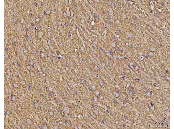 Immunohistochemistry analysis of Calcineurin Alpha